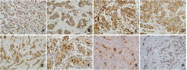 각 항체에 대한 조직염색의 대표적인 예 A. p-AKT, B. PI3K-p110 alpha, C. p-S6, D.p-RAF, E. HSP90, F. P-p70S6K, G. p-MAPK, H. PTEN