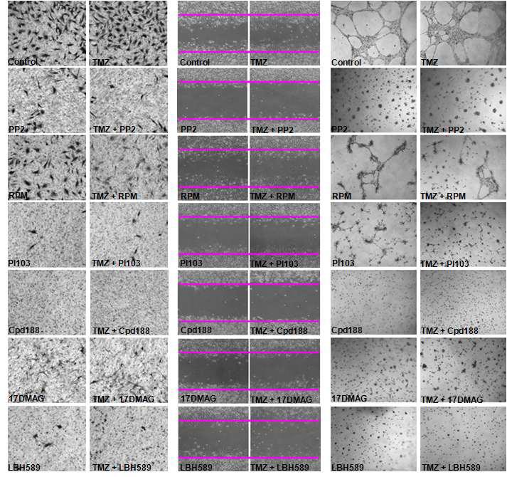 The effect on invasion, migration and vasculogenic mimicry of glioma cells