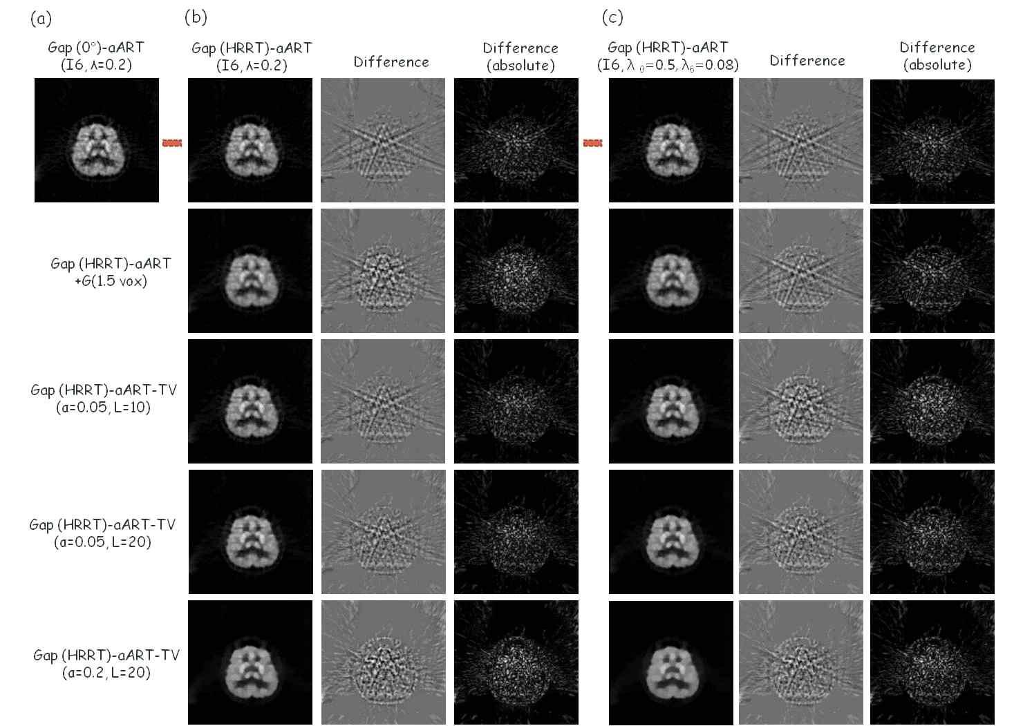 Brain의 HRRTideal과 HRRTgap 데이터의 aART와 aART-TV 재구성 결과 (6번 반복연산)와 aART(HRRTideal)-aART 혹은 aART-TV(HRRTgap)의 차이 영상