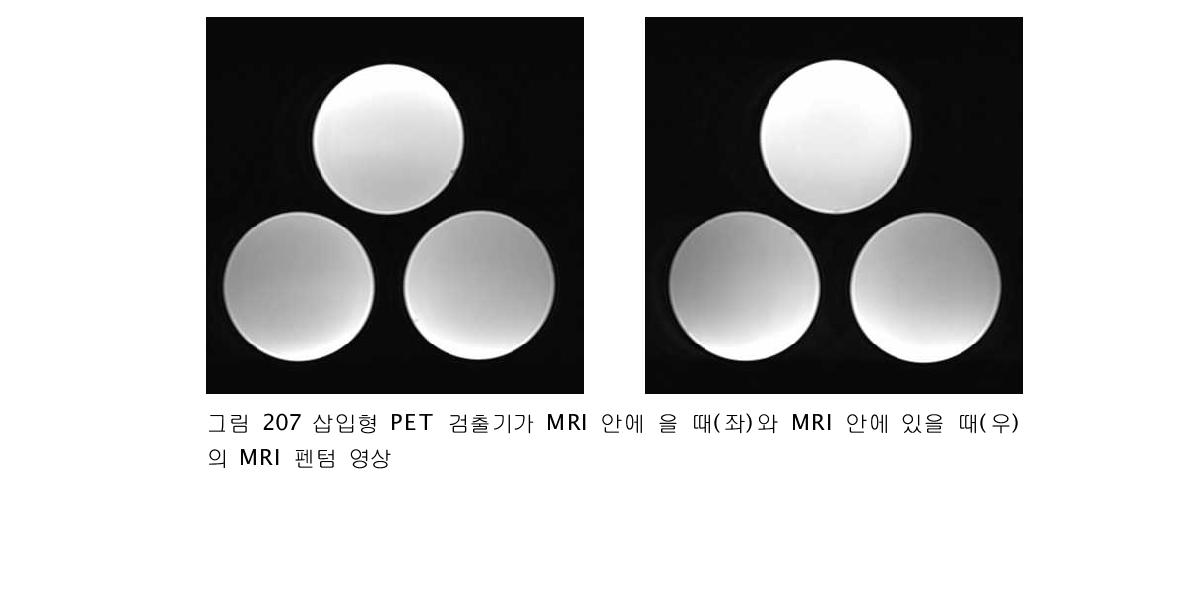 삽입형 PET 검출기가 MRI 안에 을 때(좌)와 MRI 안에 있을 때(우)