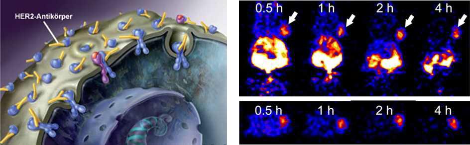 유방암 세포에서 HER2(Human epidermal growth factor receptor type 2) 수용체 발현과 마우스 모델에서 18F-FBO-ZHER2:477 PET 영상