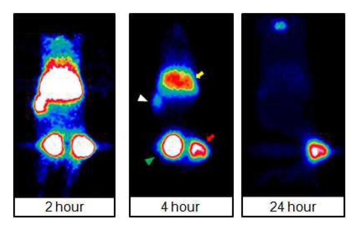 [124I]HIB-Gd-liposome 주입 후의 CT-26 동물 모델에서의 2, 4, 24 시간 후의 PET 영상.(Tumor:빨간화 살표, Liver:노란화살표, Spleen:흰색삼각형, Bladder:녹색 삼각형)