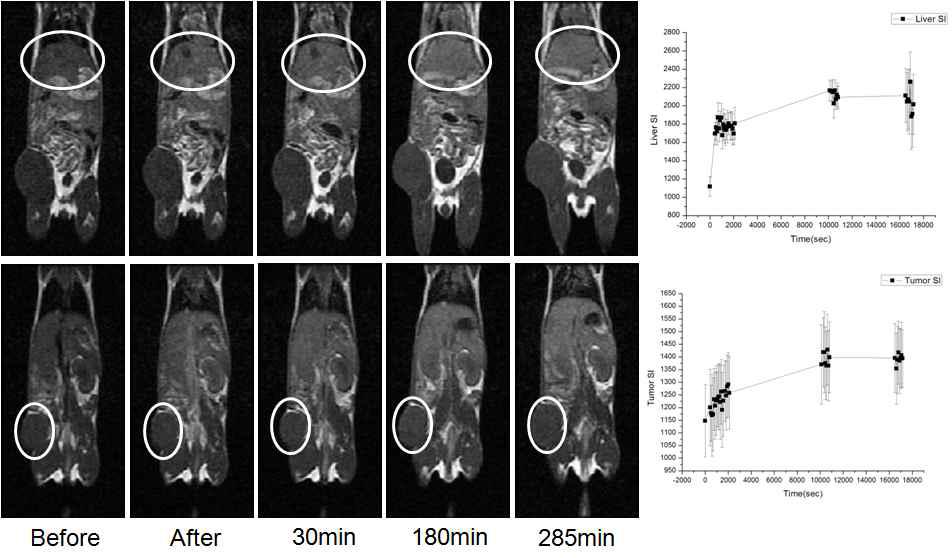 [124I]HIB-Gd-liposome을 이용한 MR imaging와 liver 와 tumor 에서의 Signal Intensity.