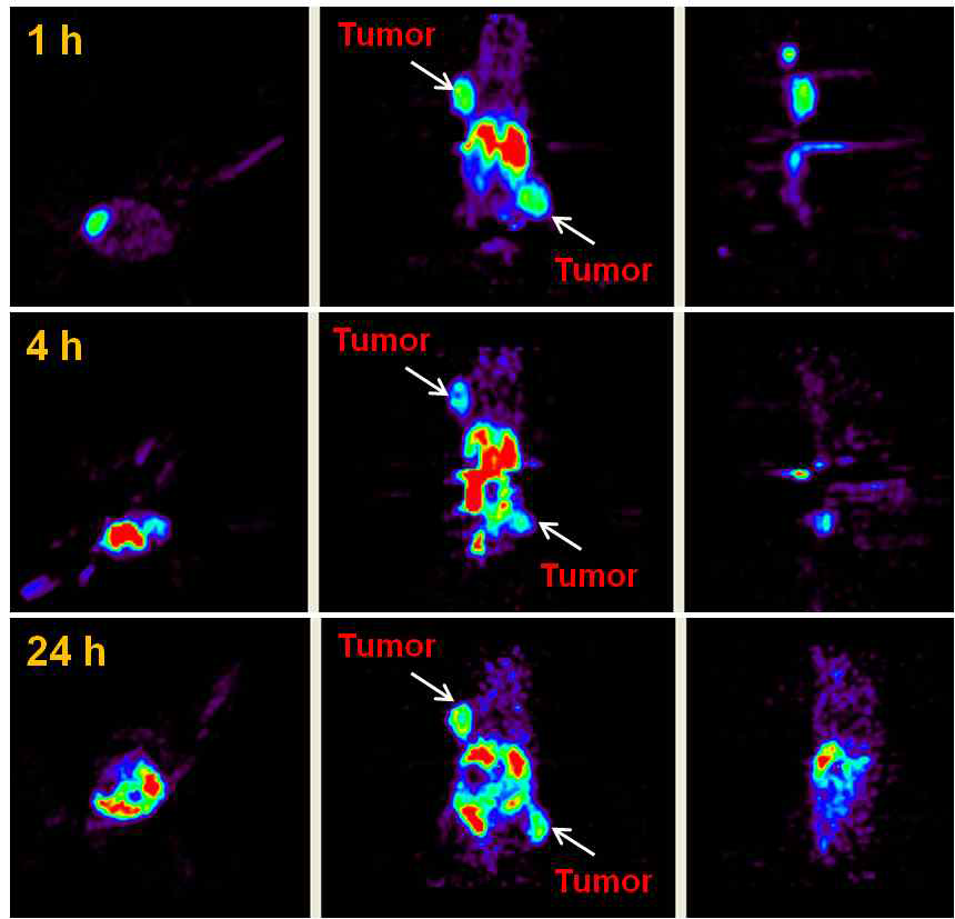 MicroPET images of female nude mice bearing U87MG tumor at 1 h, 4 h, and 24 h after injection of 64Cu-TE2A-NCS-c(RGDyK) (205μCi)