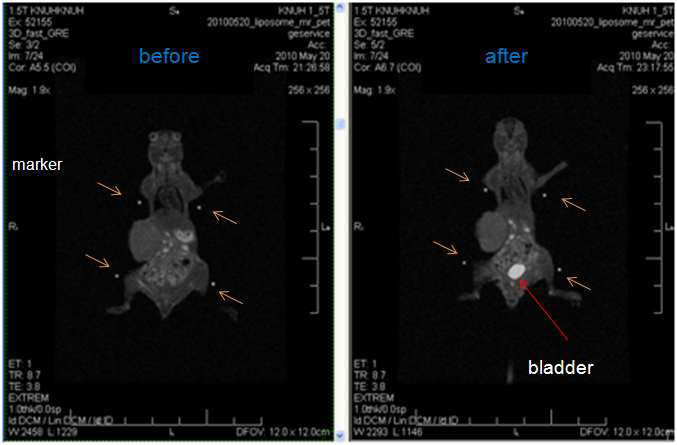 Gd-DTPA encapsulated [124I]HIB-lipsome을 통해 얻은 MR imaging