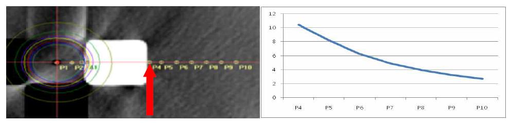 불균질 물질 bone의 P4 점에서 선량분포