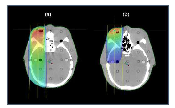 MeV(a)와 keV(b)를 이용하여 eye treatment에 대한 axial dose distribution