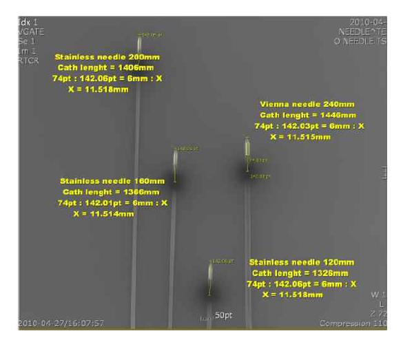 다양한 길이의 조직내 근접치료용 바늘의 방사선촬영영상