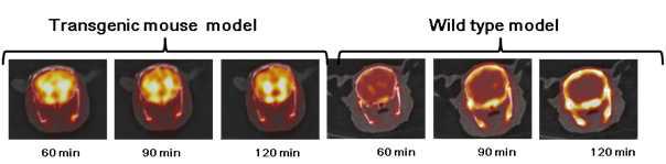 알츠하이머병 모델 형질전환 마우스(APP/PS1)와 wild type 마우스에서 SNUBH-NM-333 뇌 PET 영상 (60, 90 and 120 min)