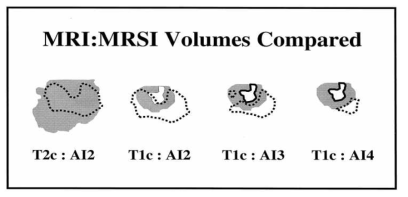 MRI/MRSI volumes in categories of interest. Dotted line-abnormality