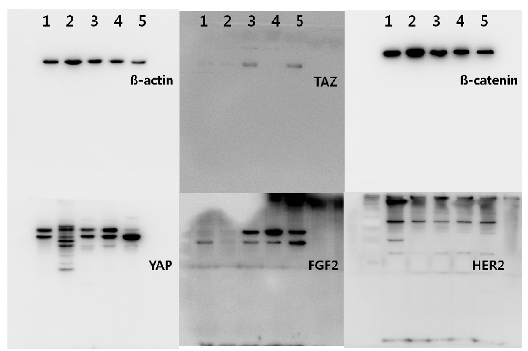 실제 위암 세포주를 사용한 웨스턴블랏(western blot) cell line 1, MKN-28; 2, MKN-45; 3, SNU-484; 4, SNU-638; 5, YCC-9