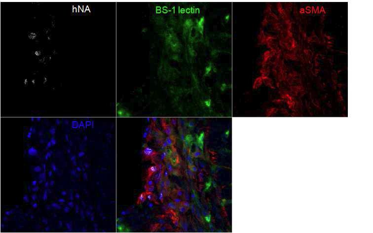 human nuclear antigen (hNA) 양성인 세포가 정맥으로 투여한 혈관내피전구세포이며 증식해 있는 중간엽세포와 함께 위치하고 있어 중간엽 세포가 전구세포, 또는 줄기세포의 Niche를 형성하고 있음을 보여주는 간접적인 증거임.