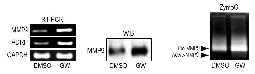 RT-PCR, Western blot , zymography