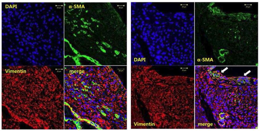 심근경색 후 3일째 경색 주변부위에서 확인된 근섬유모세포