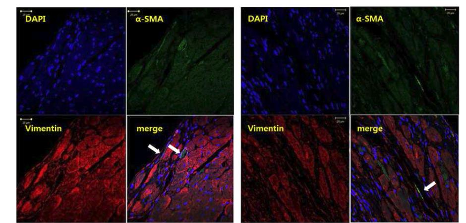 심근경색 후 2주일째 경색 주변부위에서 확인된 근섬유모세포
