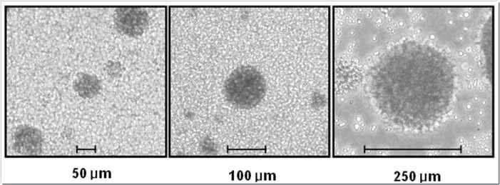 말초혈액으로부터 확보한 spheroid 형태의 혈구세포 집락 군의 다양한 크기. 50um~250um의 크기로 줄기세포Niche의 다양성과 크기에 따른 줄기세포의 효율성을 연구하는데 최적의 세포자원이라 판단됨.