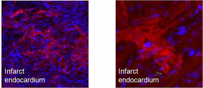 심근경색 조직에서 증식하는 중간엽세포의 형태와 위치