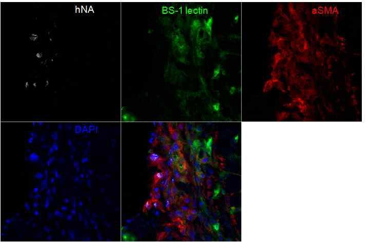 human nuclear antigen (hNA) 양성인 세포가 정맥으로 투여한 혈관내피전구세포이며 증식해 있는 중간엽세포와 함께 위치하고 있어 중간엽 세포가 전구세포, 또는 줄기세포의 Niche를 형성하고 있음을 보여주는 간접적인 증거임