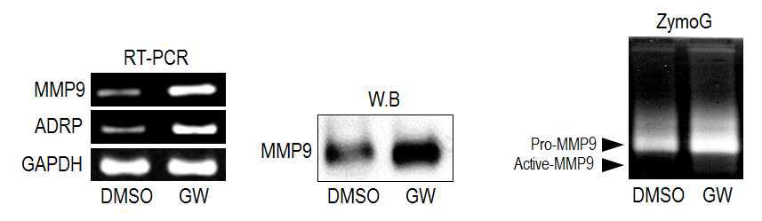 RT-PCR, Western blot, zymography