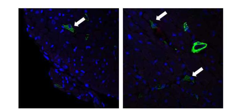 심근경색 직후 조직에서 확인된 근섬유모세포 (α-SMA: green, myofibroblast)