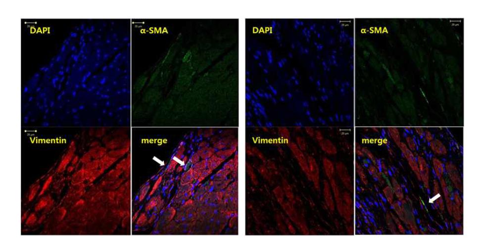 심근경색 후 2주일째 경색 주변부위에서 확인된 근섬유모세포