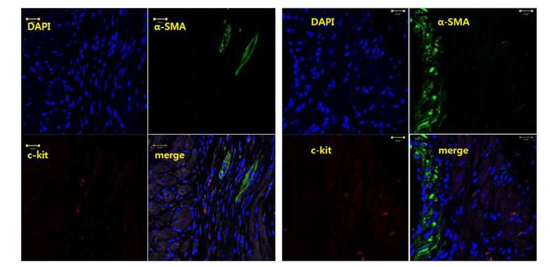 줄기세포를 투여한 심근경색 조직 (α-SMA: green, myofibroblast; c-kit: red, injected stem cell)