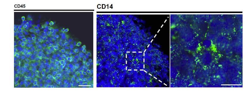 3차원 혈구세포괴의 주세포는 혈구세포 항원인 CD45 양성세포이며, 또한 CD14 골수유래의 세포가 주 세포성분임을 밝혀냄