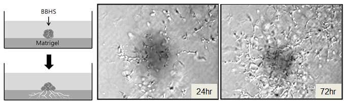 Thick matrigel에서 혈구세포괴의 혈관신생능력