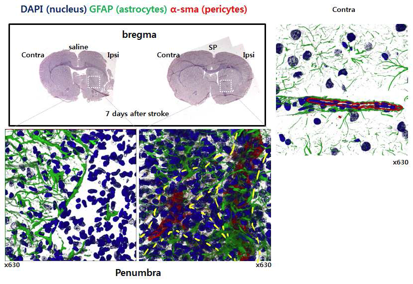 Stroke 유발 7일 후 ipsi lateral penumbra에서 pericytes는 α-SMA 으로, astrocytes는 GFAP의 면역형광염색으로 관찰하여 SP 투여군에서 pericyte의 침투 및 증식 및 BBB구성에 필수적인 astrocytes의 침투 및 증식을 확인함.