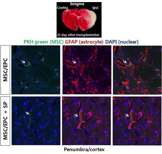 PKH -labeled M SC/ EPC의 단독 및 SP와의 공동 이식 21일 후 손상 penumbra/ cor tex 경계부위 이식한 세포가 homing되어 혈관을 형성함.
