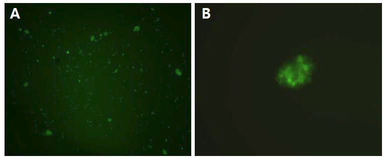 히아루론산(HA) 고분자 유도체(HA-DOPA) 내에서 배양된 신경줄기세포의 viability 분석(Live/Dead 염색 방법). (A) 신경줄기세포. (B) 신경줄기세포가 형성한 neurosphere.