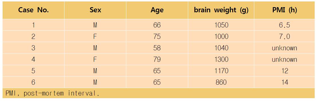 List of human brains