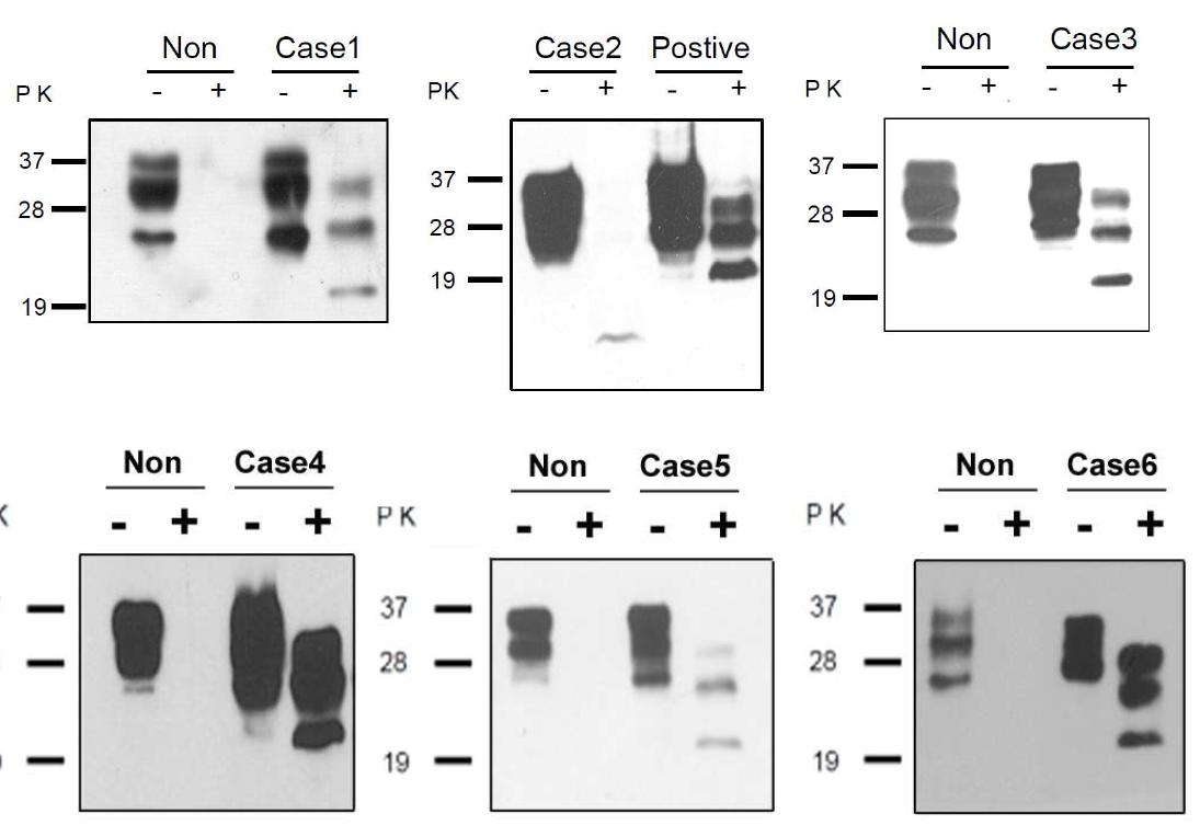 Detection of proteinase K (PK)-resistant PrPSc. Brain homogenates were loaded ontoSDS-PAGE, and then transfered to PVDF membrane, then Western blotting was performed using anti-PrP antibody.