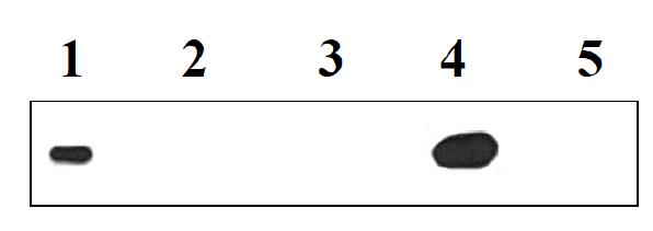 Detection of 14-3-3 proteins in human cerebrospinal fluid. Lanes 1, positive control.