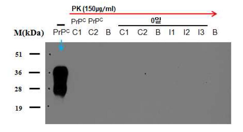 PrP detection in plasma of human control and sporadic CJD patient by western blot.