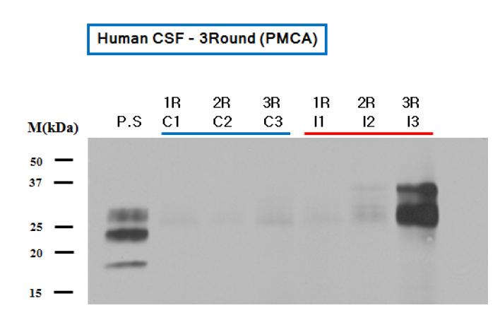 왼쪽의 3개(C1, C2, C3)는 정상 Human의 CSF를 채취하여 정상의 Hu-Tg mice brainhomogenate(10%)와 혼합하여 PMCA를 사용해서 1~3Round(1 Round-> 2일소요, 3 Round -> 6일 소요)돌린 샘플을 PK 처리 후 Western blot을 한 결과, 검출이 되지 않음. 하지만 오른쪽 3 개는 환자의 CSF를 채취하여 정상의 Hu-Tg mice brain homogenate(10%)를 혼합하여 같은 방 법으로 PMCA를 1~3Round 돌린 샘플을 PK 처리 후 Western blot을 한 결과 3R에서 검출이 확인되었음. PMCA