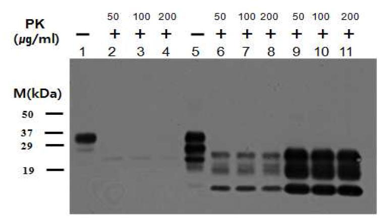 The band pattern of PrP by the concentration of PK and brain homogenate using western blot analysis