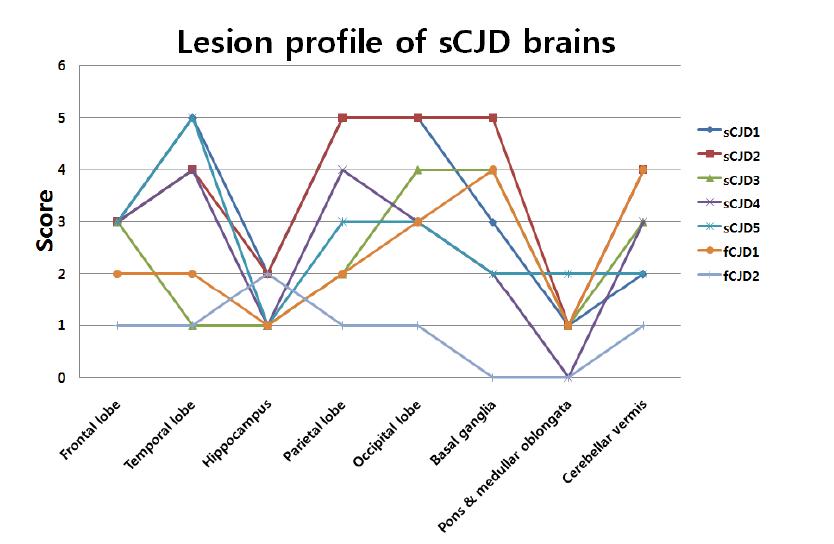 Lesion profile of sCJD brains