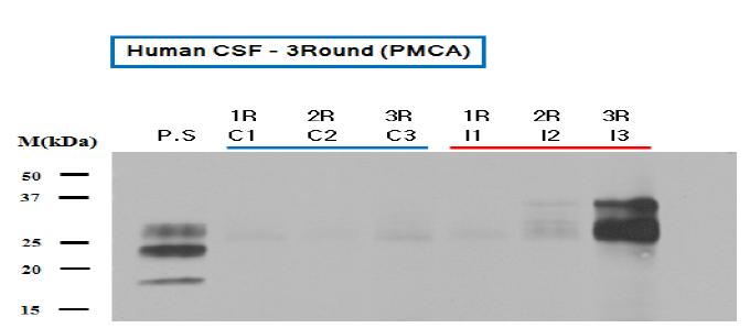 정상 Human의 CSF인 C1-C3는 PrPSc가 검출이 되지 않았고 CJD 환자인 I1-I3는 3R에서 PrPSc가 다량 검출되었음