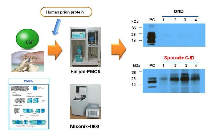 Modified Hallym-PMCA를 이용하여 국내발생 CJD환자의 CSF에서 PrPSc의 증폭결과