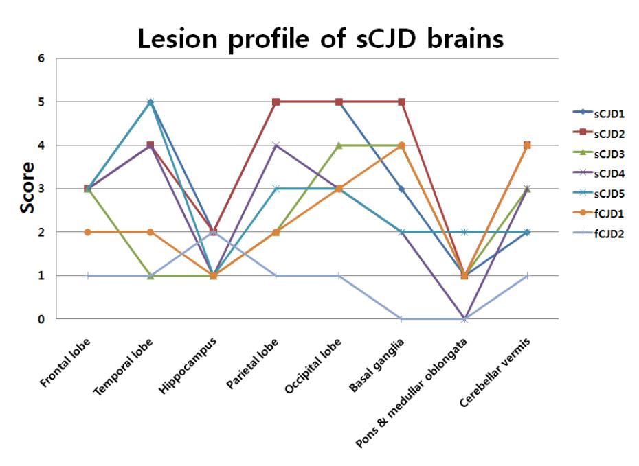 Lesion profile of sCJD brains