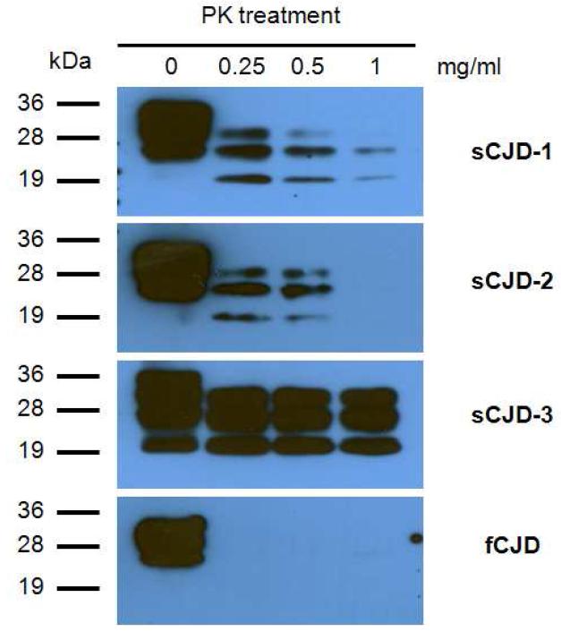 인간 프리온 질환 부검 샘플별 단백질분해효소(Proteinase K)에 대한 저항성 분석.