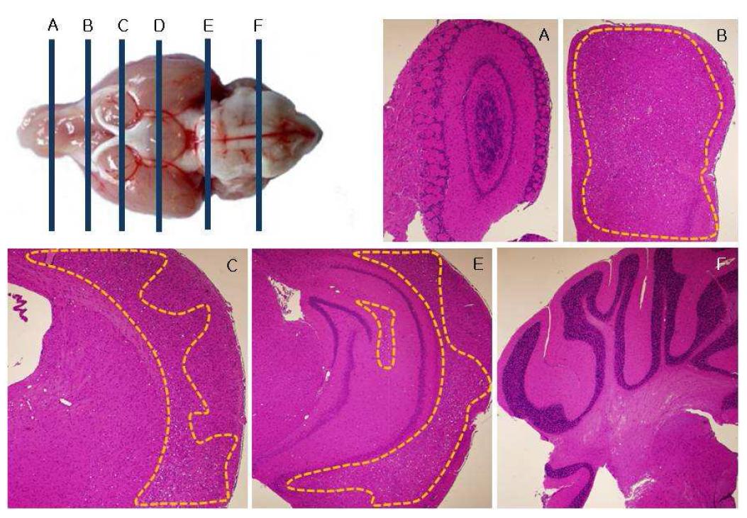 Transmission of sCJD to Hum anized PrP Tg mouse