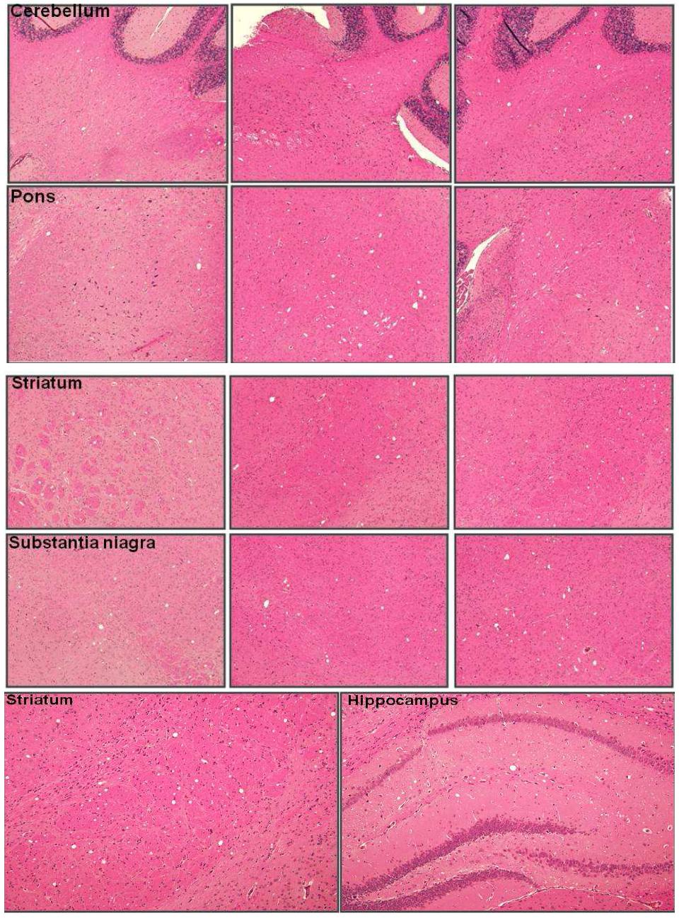 Pathology of elkTg-mice adapted CWD transmission to HuTg-mice.