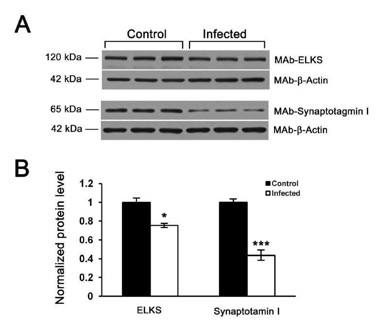 ELKS, an active zone matrix protein, and Synaptotagmin I in scrapie-infected mousehippocampus were decreased.