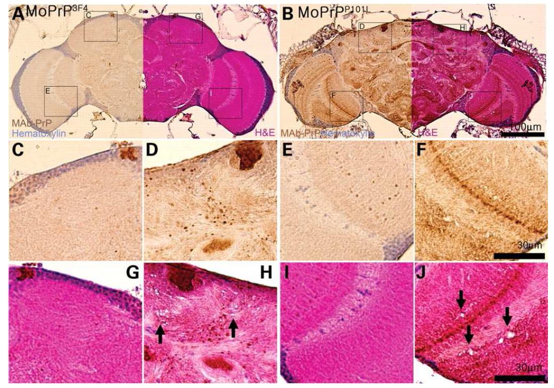 PrP deposits and vacuoles in MoPrPP101L adult head.