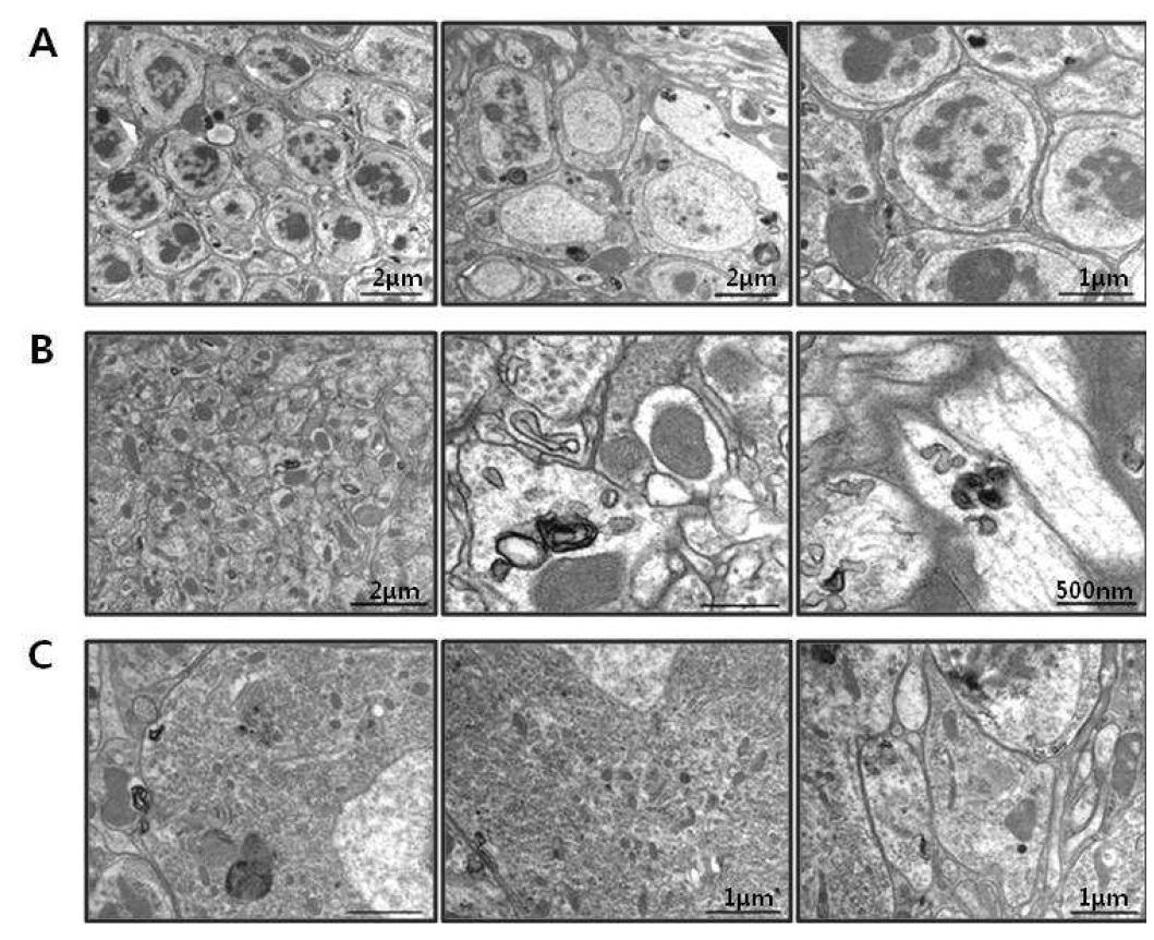 Ultrastructural observation of the normal mouse PrP (MoPrP3F4) protein expressed brain of adult(aging) drosophila.