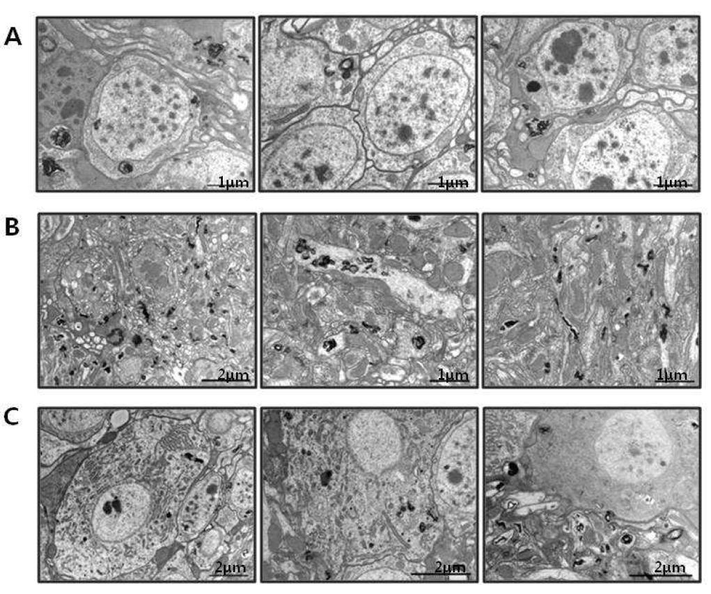 Ultrastructural observation of the mutant mouse PrP (MoPrPP101L) protein expressed brain of adult(aging) drosophila.