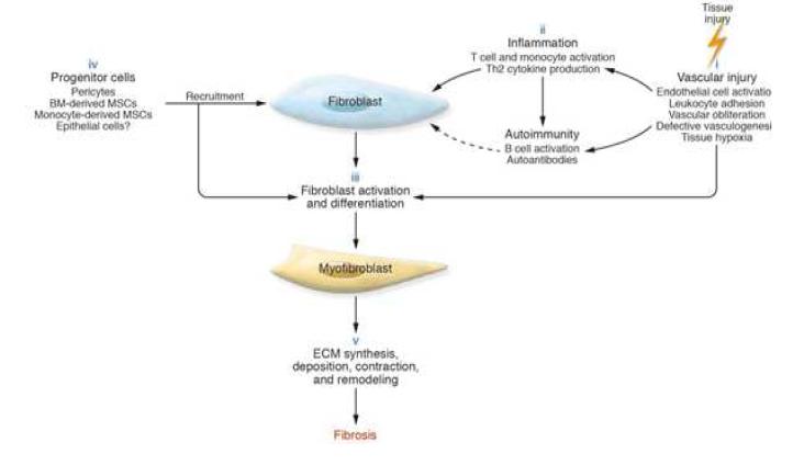 Proposed pathogenesis of fibrosis