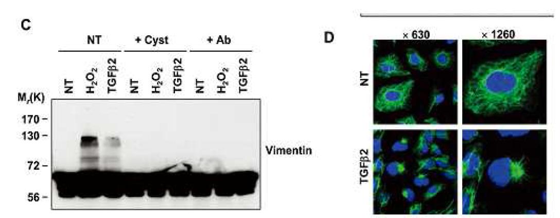 Collapse of cytoskeleton by TGase 2 activation